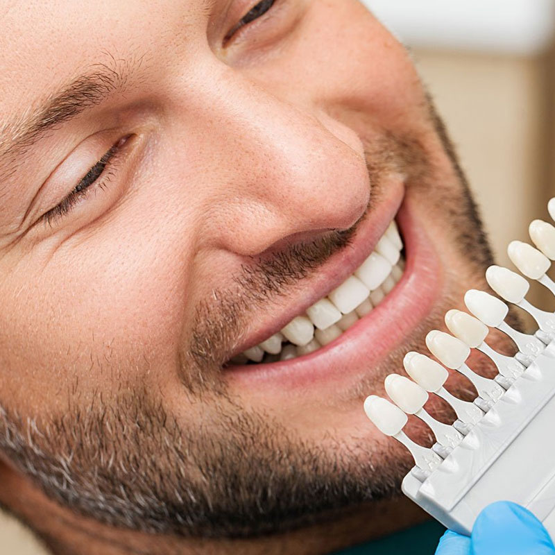 Dental Veneers Treatment